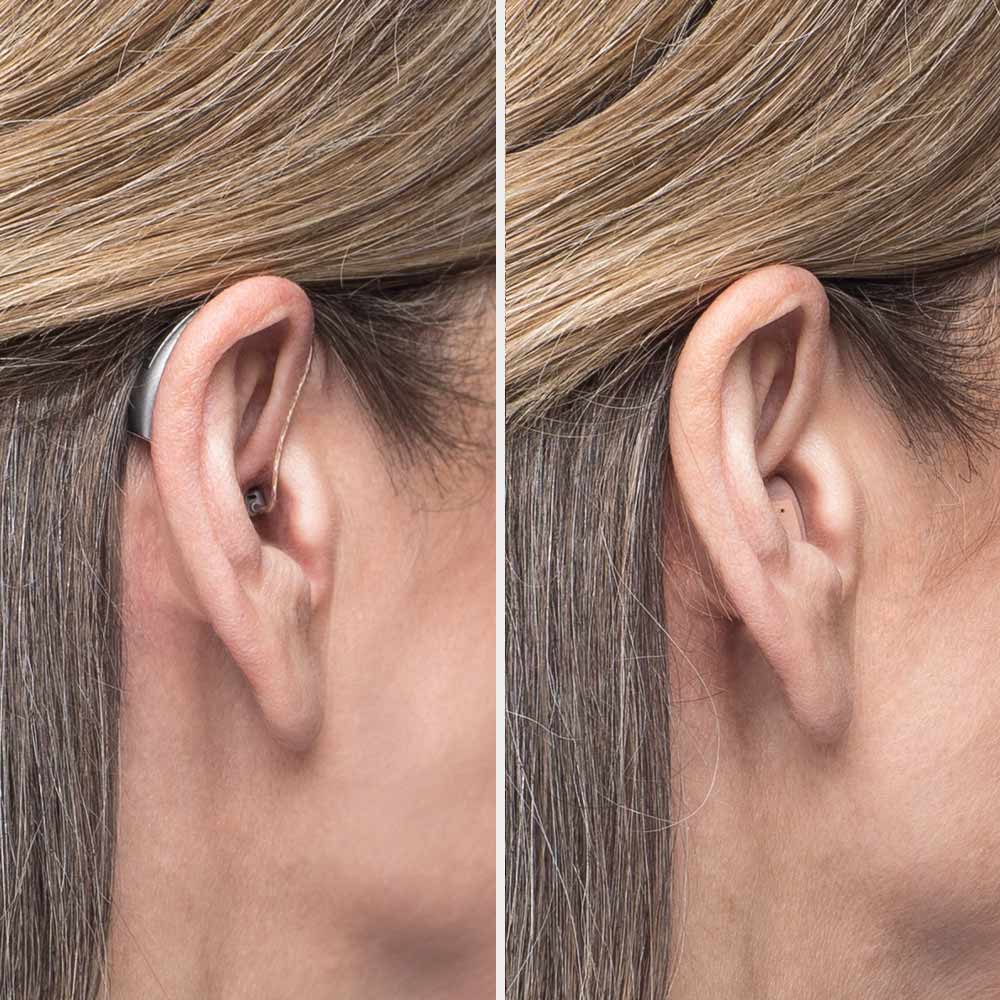 Hörgeräte am Ohr